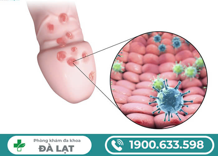 Hình ảnh minh họa